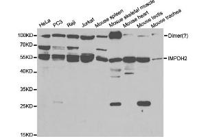 Western blot analysis of extracts of various cell lines, using IMPDH2 antibody (ABIN5973086) at 1/1000 dilution.