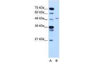 WB Suggested Anti-TYRP1 Antibody Titration:  2. (Tyrosinase-Related Protein 1 antibody  (N-Term))