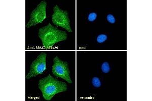 (ABIN185503) Immunofluorescence analysis of paraformaldehyde fixed U2OS cells, permeabilized with 0. (BRSK2 antibody  (Internal Region))