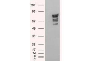 Image no. 1 for anti-phosphodiesterase 4D, cAMP-Specific (PDE4D) (C-Term) antibody (ABIN374635)