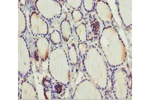 Immunohistochemistry of paraffin-embedded human thyroid tissue using ABIN7159798 at dilution of 1:100 (MTUS1 antibody  (AA 1041-1270))