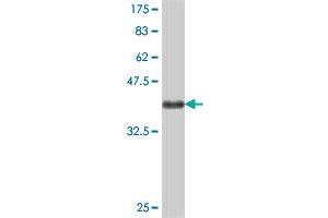 Western Blot detection against Immunogen (36. (CRELD2 antibody  (AA 162-258))