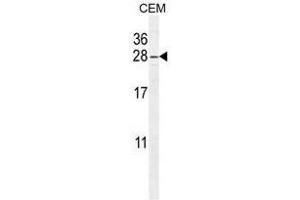 ARL8 Antibody (C-term) western blot analysis in CEM cell line lysates (35µg/lane).