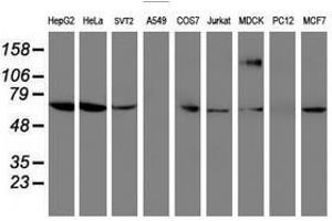 Image no. 3 for anti-Folate Hydrolase (Prostate-Specific Membrane Antigen) 1 (FOLH1) antibody (ABIN1500454) (PSMA antibody)