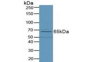 Detection of PLD in Porcine Small Intestine Tissue using Polyclonal Antibody to Phospholipase D (PLD) (Phospholipase D antibody  (AA 725-1074))