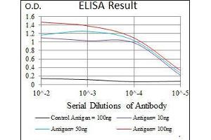 Black line: Control Antigen (100 ng), Purple line: Antigen(10 ng), Blue line: Antigen (50 ng), Red line: Antigen (100 ng), (STAT5A antibody  (AA 583-794))