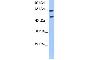 WB Suggested Anti-ZNF449 Antibody Titration: 0. (ZNF449 antibody  (Middle Region))