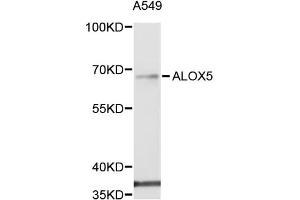 Western blot analysis of extracts of A-549 cells, using ALOX5 antibody (ABIN5971185) at 1/1000 dilution. (ALOX5 antibody)