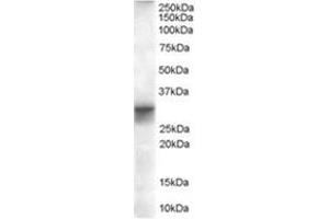 Image no. 1 for anti-Four and A Half LIM Domains 1 (FHL1) (Internal Region) antibody (ABIN374472) (FHL1 antibody  (Internal Region))