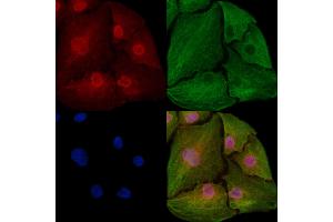 ABIN6259941 and ABIN6273031 staining  cells by IF/ICC.