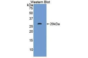 Detection of Recombinant ITLN1, Human using Polyclonal Antibody to Intelectin 1 (ITLN1) (ITLN1/Omentin antibody  (AA 31-253))