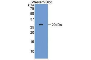 Detection of Recombinant ITLN1, Human using Polyclonal Antibody to Intelectin 1 (ITLN1)