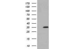 HEK293T cells were transfected with the pCMV6-ENTRY control (Left lane) or pCMV6-ENTRY SDR9C7 (Right lane) cDNA for 48 hrs and lysed. (SDR9C7 antibody)