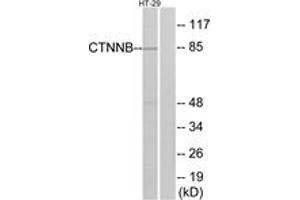 Western blot analysis of extracts from HT-29 cells, treated with Forskolin, using Catenin-beta (Ab-37) Antibody. (beta Catenin antibody  (AA 3-52))