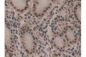 Detection of HDGF in Human Stomach Tissue using Polyclonal Antibody to Hepatoma Derived Growth Factor (HDGF)