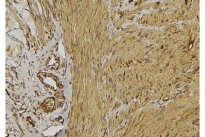 Immunohistochemistry (IHC) image for anti-Adrenergic, beta-2-, Receptor, Surface (ADRB2) (C-Term) antibody (ABIN6259810)