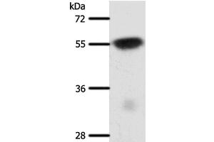 Western Blot analysis of Mouse brain tissue using SLC32A1 Polyclonal Antibody at dilution of 1:950 (SLC32A1 antibody)