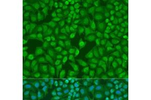 Immunofluorescence analysis of U2OS cells using MonoMethyl-UHRF1-K385 Polyclonal Antibody at dilution of 1:100. (UHRF1 antibody  (meLys385))