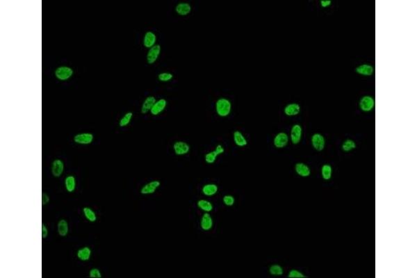 Recombinant HIST1H2BB antibody  (acLys20)