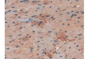 DAB staining on IHC-P; Samples: Human Heart Tissue (Haptoglobin antibody  (AA 70-332))