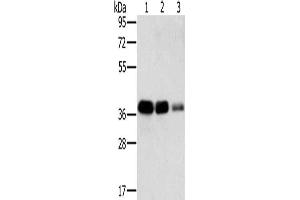Gel: 8 % SDS-PAGE, Lysate: 40 μg, Lane 1-3: A549 cells, HT29 cells, A172 cells, Primary antibody: ABIN7130292(MTFR1 Antibody) at dilution 1/500, Secondary antibody: Goat anti rabbit IgG at 1/8000 dilution, Exposure time: 5 seconds