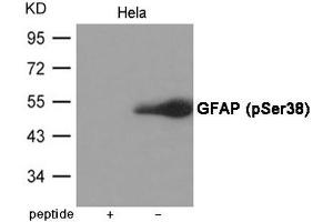 Western blot analysis of extracts from Hela cells using GFAP (Phospho-Ser38) Antibody. (GFAP antibody  (pSer38))