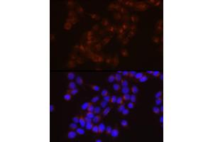 Immunofluorescence analysis of HeLa cells using LDL Receptor (LDLR) Rabbit mAb  at dilution of 1:150 (40x lens). (LDLR antibody)