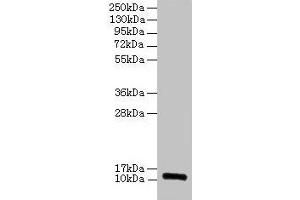 RPLP1 Antikörper  (AA 2-114)