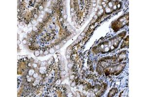 IHC analysis of CSNK2K2 using anti-CSNK2K2 antibody (ABIN7602871). (CSNK2A2 antibody  (C-Term))