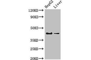 Western Blot Positive WB detected in: HepG2 whole cell lysate, Mouse liver tissue All lanes: GPER1 antibody at 4 μg/mL Secondary Goat polyclonal to rabbit IgG at 1/50000 dilution Predicted band size: 43 kDa Observed band size: 43 kDa (Mesothelin antibody  (AA 1-62))