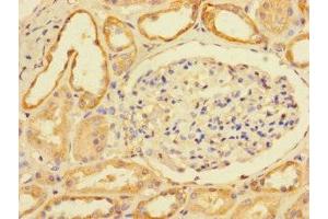 Immunohistochemistry of paraffin-embedded human kidney tissue using ABIN7174868 at dilution of 1:100