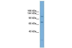 Western Blot showing PARP10 antibody used at a concentration of 1-2 ug/ml to detect its target protein. (PARP10 antibody  (N-Term))