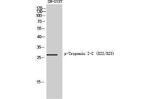 Western Blotting (WB) image for anti-Cardiac Troponin C (TNNC1) (pSer22), (pSer23) antibody (ABIN3182561)
