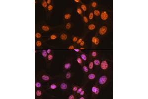 Immunofluorescence analysis of NIH-3T3 cells using PTBP1 Rabbit mAb (ABIN7269464) at dilution of 1:100 (40x lens). (PTBP1 antibody)