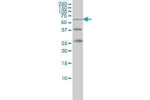 RIOK3 monoclonal antibody (M02), clone 3G11 Western Blot analysis of RIOK3 expression in K-562 . (RIOK3 antibody  (AA 411-516))