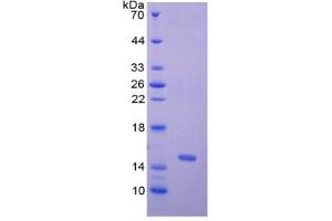 SDS-PAGE (SDS) image for Nephrosis 1, Congenital, Finnish Type (Nephrin) (NPHS1) ELISA Kit (ABIN6574241)