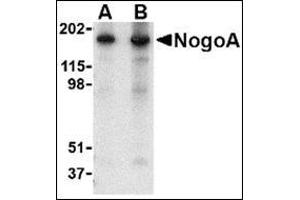 Western blot analysis of NogoA in mouse brain tissue lysate with this product at (A) 0. (Reticulon 4 antibody  (Isoform 1, N-Term))