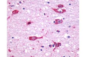 Anti-CHRM5 antibody IHC of human brain, neurons and glia. (CHRM5 antibody  (Cytoplasmic Domain))