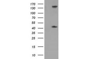Western Blotting (WB) image for anti-phosphoribosylaminoimidazole Carboxylase, phosphoribosylaminoimidazole Succinocarboxamide Synthetase (PAICS) antibody (ABIN1500021) (PAICS antibody)