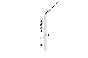 Anti-MLL2 Antibody  at 1:27000 dilution + HL2 recombinant protein Lysates/proteins at 20 μg per lane.
