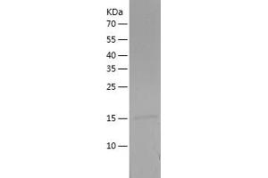 CST3 Protein (AA 29-148) (His tag)