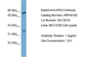 WB Suggested Anti-APEH  Antibody Titration: 0. (APEH antibody  (Middle Region))