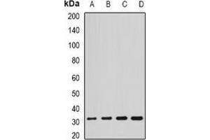 Western blot analysis of SCO2 expression in HL60 (A), SKOV3 (B), mouse brain (C), rat liver (D) whole cell lysates. (SCO2 antibody)