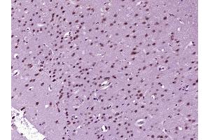 Paraformaldehyde-fixed, paraffin embedded Mouse brain Antigen retrieval by boiling in sodium citrate buffer (pH6. (DFFB antibody  (AA 251-338))