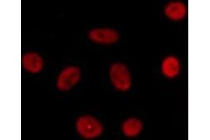 SCAF4 antibody  (C-Term)