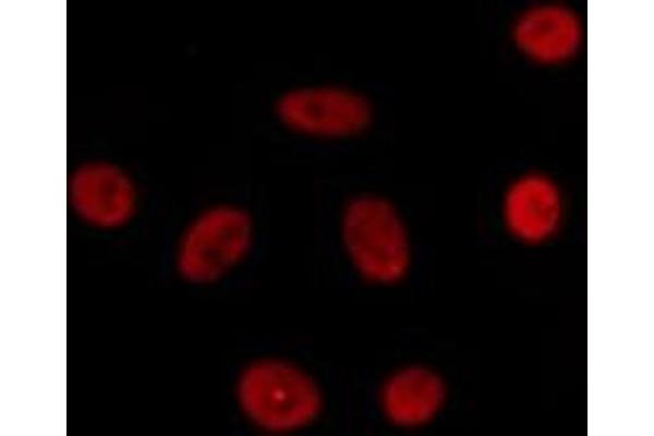 SCAF4 antibody  (C-Term)