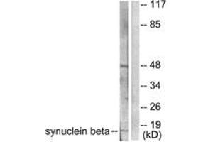 Western blot analysis of extracts from HeLa cells, using Synuclein beta Antibody. (beta Synuclein antibody  (AA 85-134))
