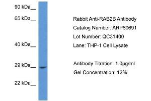 Western Blotting (WB) image for anti-RAB2B, Member RAS Oncogene Family (RAB2B) (C-Term) antibody (ABIN2788539) (RAB2B antibody  (C-Term))