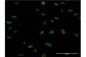 Immunofluorescence of monoclonal antibody to NUCKS1 on HeLa cell.