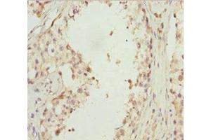 Immunohistochemistry of paraffin-embedded human testis tissue using ABIN7151422 at dilution of 1:100